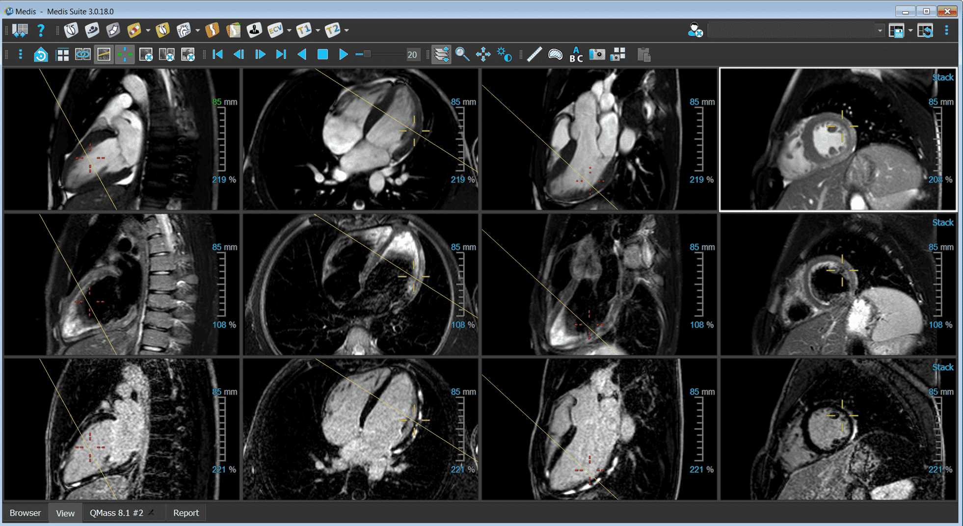 MedisSuiteMR medical imaging software example